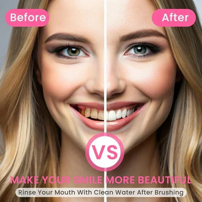 🦷Triple Fluoride-Free Whitening Niacinamide Toothpaste